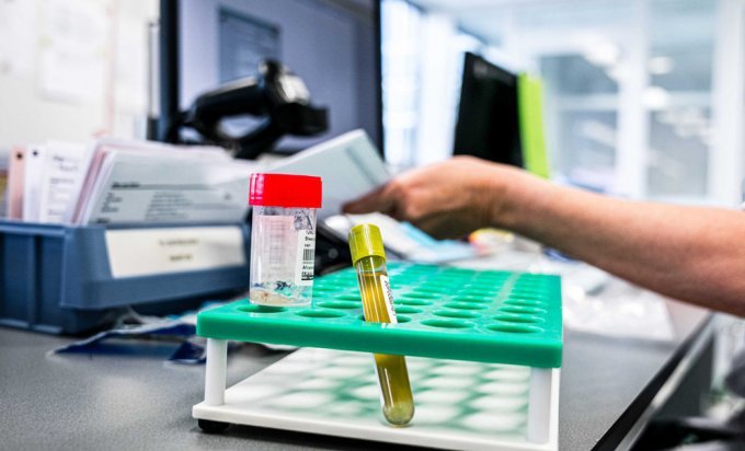 U RS 21 osoba preminula, 355 novih slučajeva zaraze virusom korona U RS 21 osoba preminula, 355 novih slučajeva zaraze virusom korona
