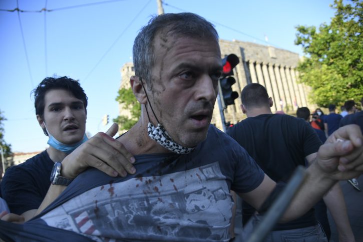 Sergej Trifunović napadnut na protestu, pukla mu arkada! Jurili ga i gađali flašama Sergej Trifunović napadnut na protestu, pukla mu arkada! Jurili ga i gađali flašama