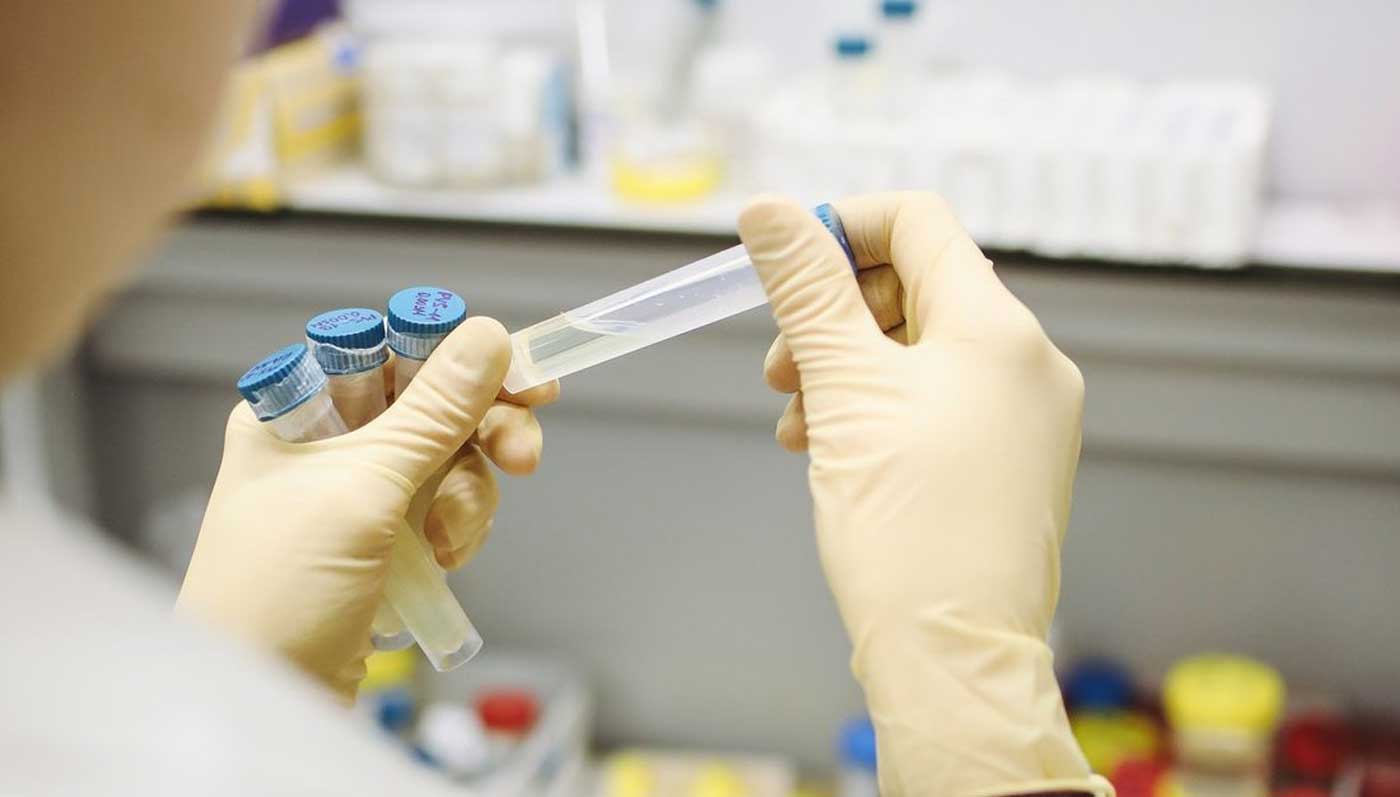 Virus korona potvrđen kod još 74 osobe u RS, dvoje preminulo Virus korona potvrđen kod još 74 osobe u RS, dvoje preminulo