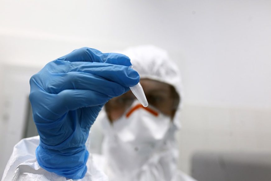 Testiranje u kampu u Velikoj Kladuši: Na virus korona pozitivno 135 migranata Testiranje u kampu u Velikoj Kladuši: Na virus korona pozitivno 135 migranata