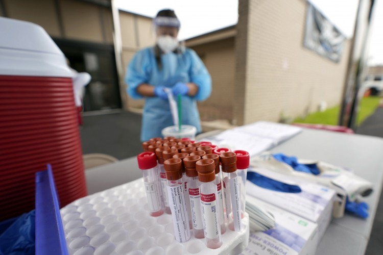 U Srpskoj preminula jedna osoba, još 16 zaraženih U Srpskoj preminula jedna osoba, još 16 zaraženih