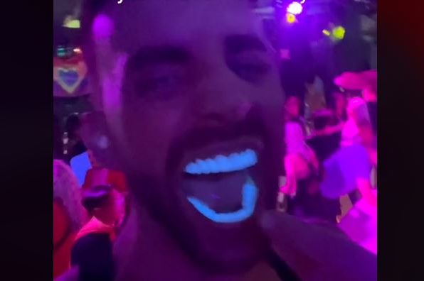 Blještaviji od budućnosti: U Turskoj nabavio nove zube, pa izašao u klub i postao hit (VIDEO)