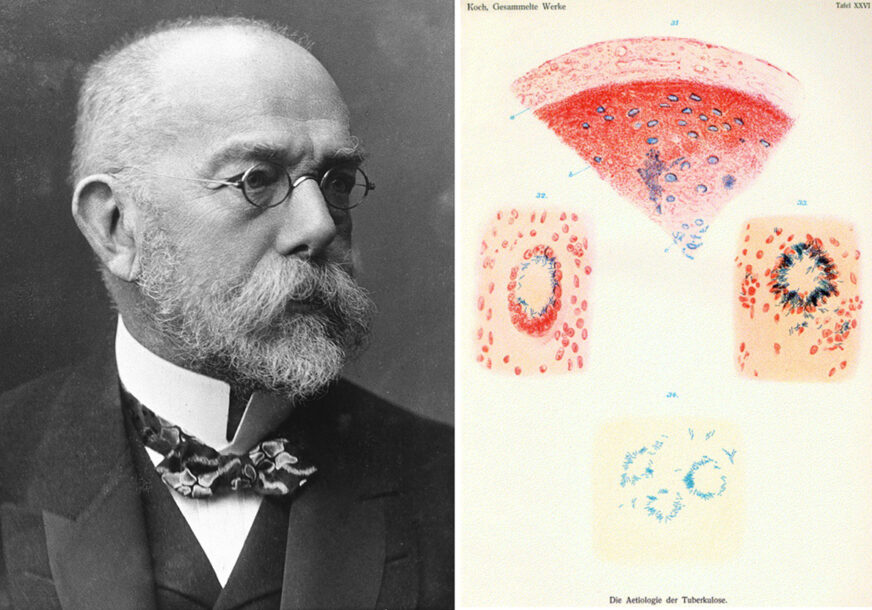 24. mart kroz istoriju: Robert Koh otkrio bakteriju koja izaziva tuberkulozu