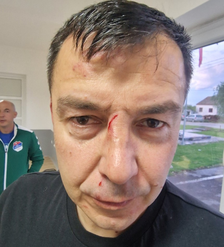 Trojica uhapšena zbog napada na glavnog sudiju Trojica uhapšena zbog napada na glavnog sudiju