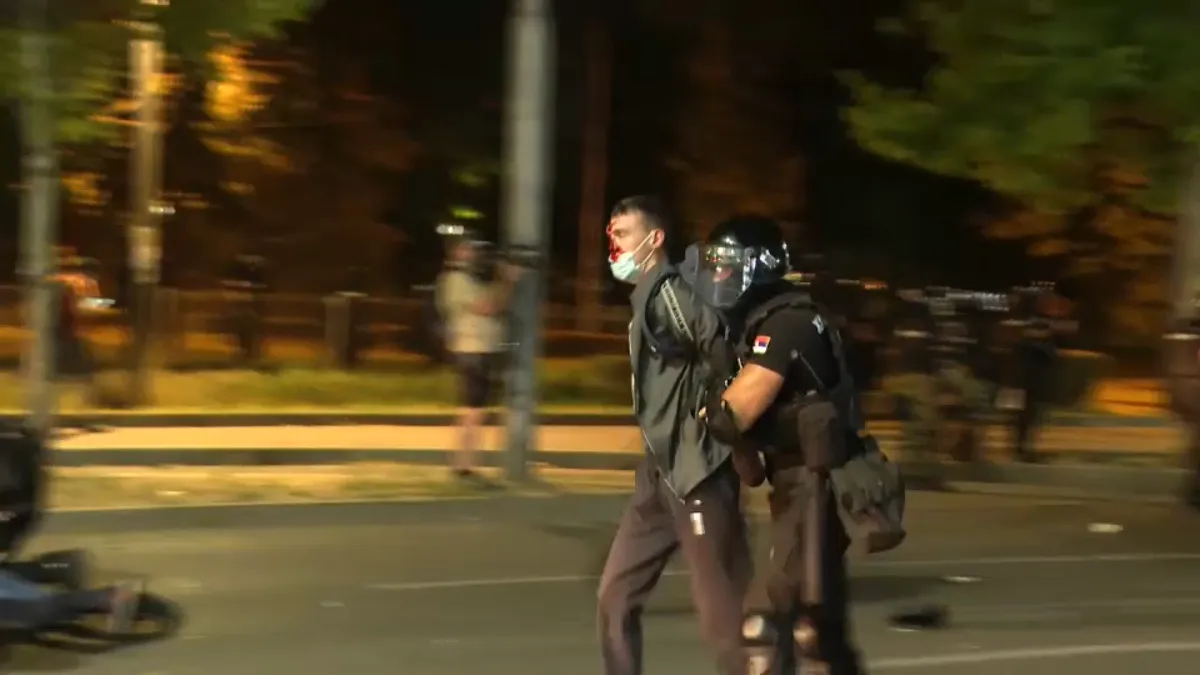 (FOTO) Kako izgledaju povrede studenta Luke kojeg je prebila policija